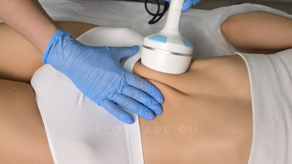 курс коррекция фигуры на аппарате velashape-2