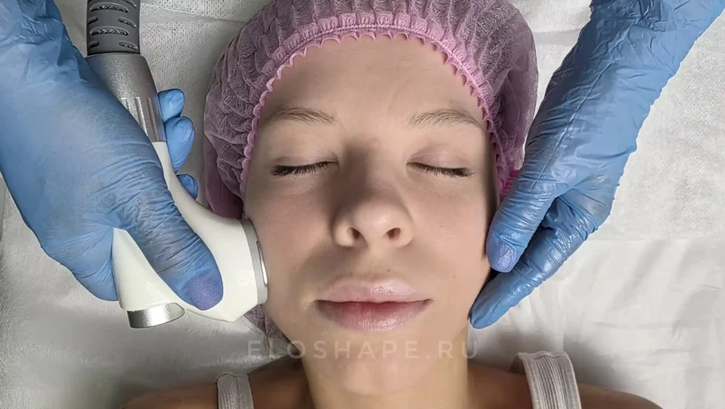 курс коррекция фигуры на аппарате velashape-4