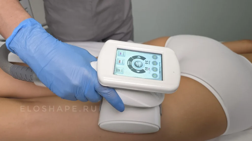 курс коррекция фигуры на аппарате velashape