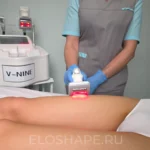 Отечность и тяжесть в ногах после вакуумно-роликового массажа