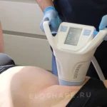 Аллергия на антицеллютный крем у клиентки после процедуры